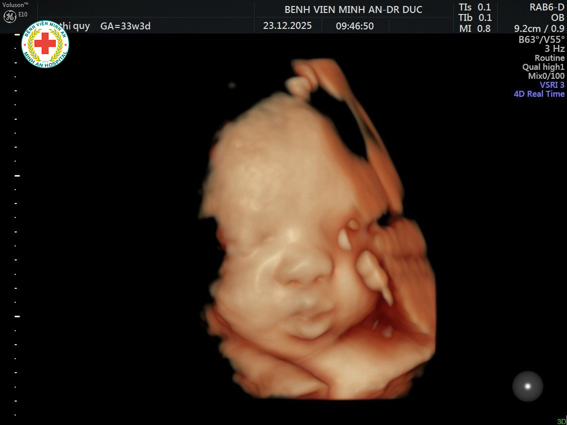 Siêu âm 5D thai nhi – Yêu ngay từ cái nhìn đầu tiên