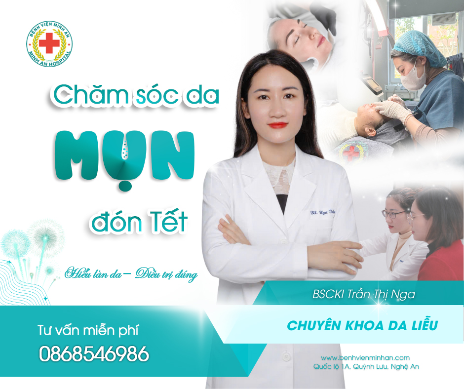 BÍ QUYẾT CHĂM SÓC DA MỤN ĐÓN TẾT 