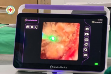 🔴 TÁN SỎI NIỆU QUẢN THÀNH CÔNG CHO BỆNH NHÂN 67 TUỔI – GIẢI QUYẾT CƠN ĐAU SAU NHIỀU NGÀY KHÓ CHỊU