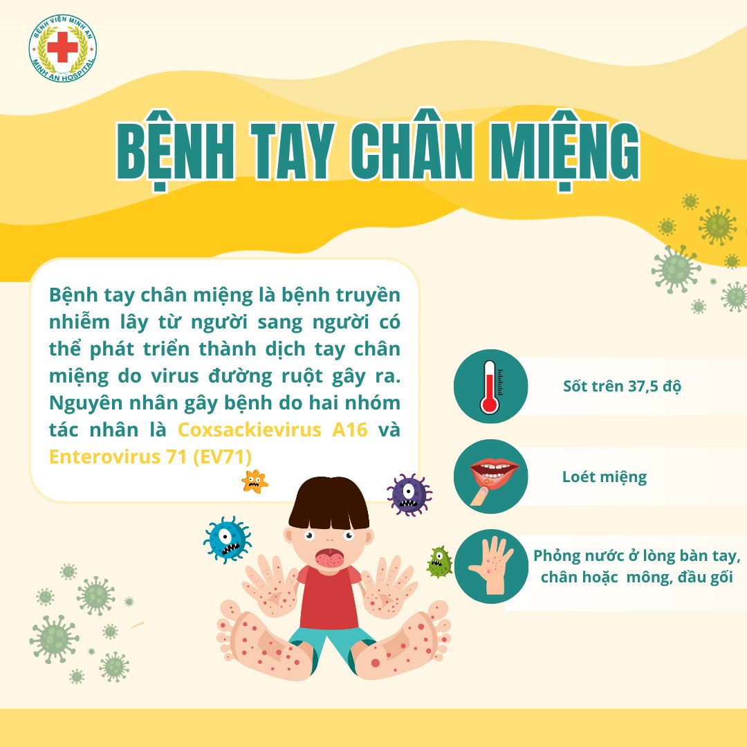 🚨 CẢNH BÁO: TAY CHÂN MIỆNG ĐANG GIA TĂNG – PHỤ HUYNH ĐỪNG CHỦ QUAN!