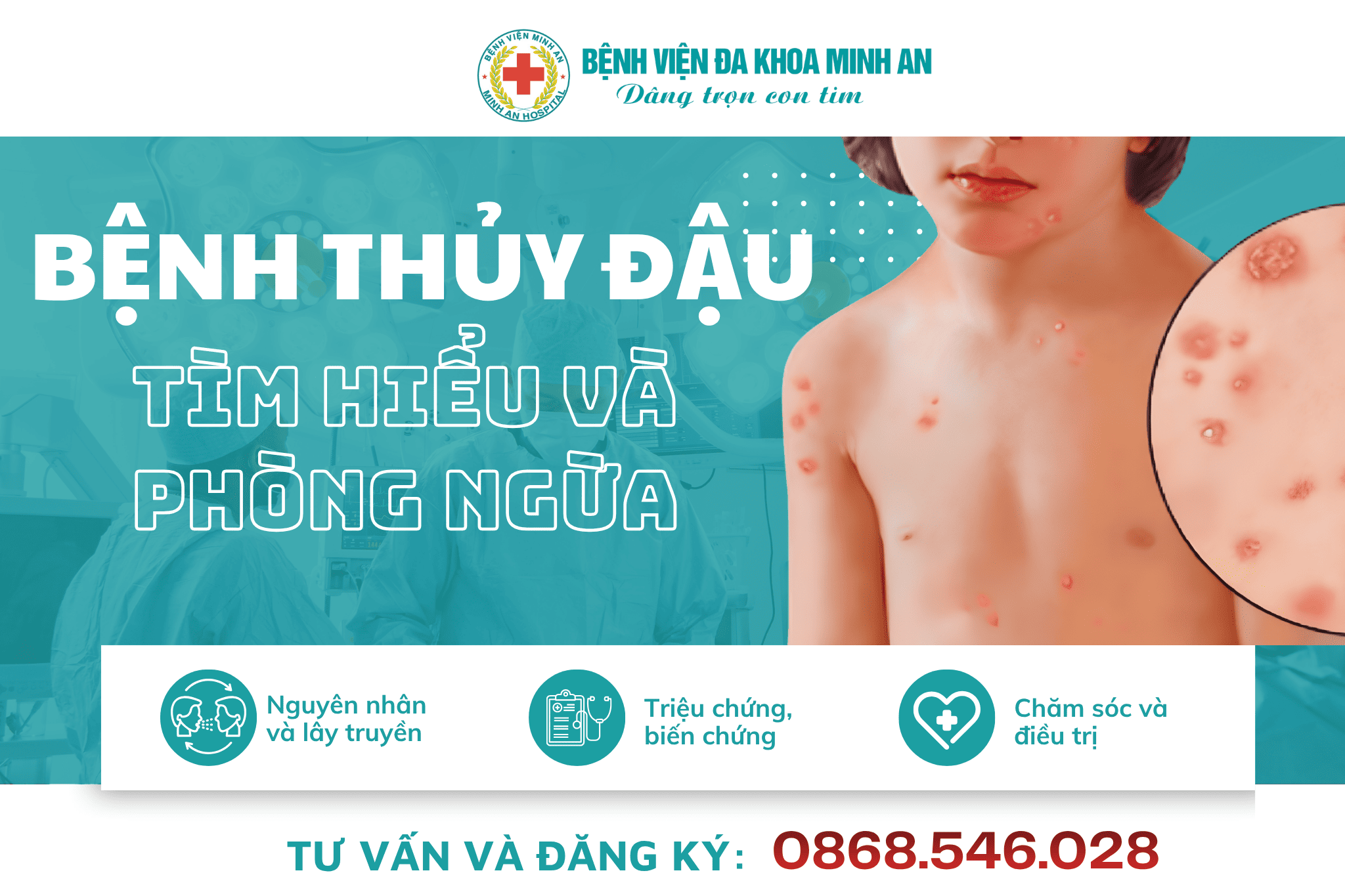 📌5 KIẾN THỨC CẦN BIẾT VỀ BỆNH THỦY ĐẬU BẠN KHÔNG NÊN BỎ QUA