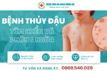 📌5 KIẾN THỨC CẦN BIẾT VỀ BỆNH THỦY ĐẬU BẠN KHÔNG NÊN BỎ QUA