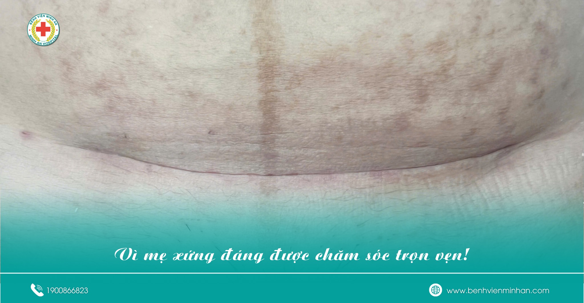 💙 VÌ MẸ XỨNG ĐÁNG ĐƯỢC CHĂM SÓC TRỌN VẸN