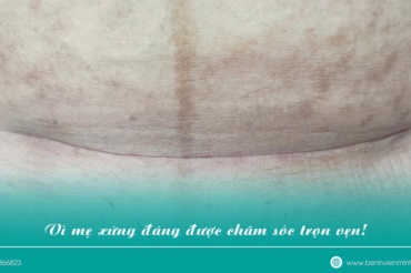 💙 VÌ MẸ XỨNG ĐÁNG ĐƯỢC CHĂM SÓC TRỌN VẸN