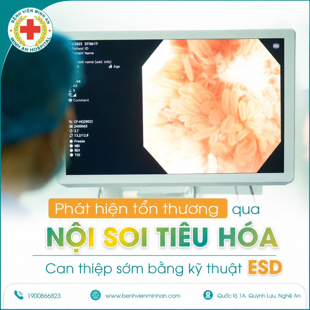 Can thiệp ESD qua nội soi tiêu hóa tại BVĐK Minh An